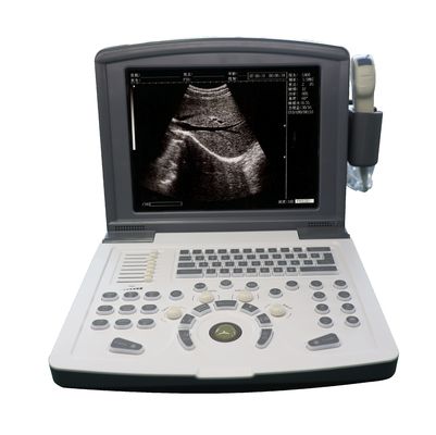 Tragbarer volldigitaler Ultraschalldiagnostischer Scanner OEM