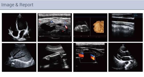 Kardiovaskuläre Kardiologie tragbare volle Figital-Farb-Doppler-Ultraschall-Scanner-Maschine