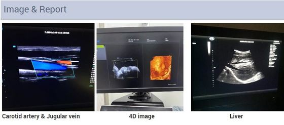 2D Echokardiografie-Herzlaufkatze Echo Color Doppler Ultrasound Machine 3D 4D