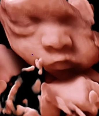 Doppler-Ultraschall-Laufkatzen-Ultraschall-Scanner 3D 4D 5D Farbfür OB GYN