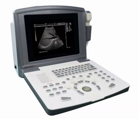 Tragbarer volldigitaler Ultraschalldiagnostischer Scanner OEM