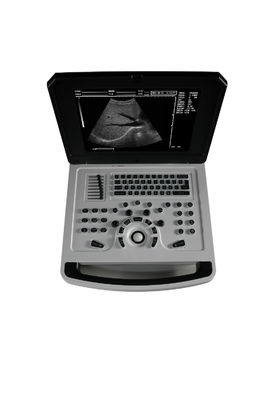 Notebook Schwarz-Weiß Ultraschall-Scanner für die Kardiologie