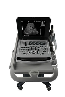 Notebook Schwarz-Weiß Ultraschall-Scanner für die Kardiologie