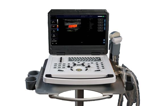CE tragbare Farb-Doppler-Ultraschallmaschinen-Scanner