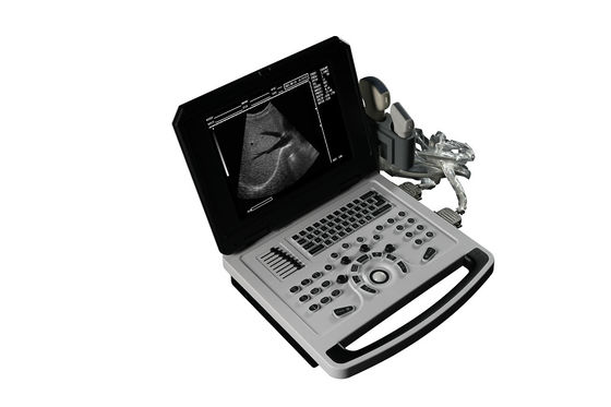 Notebook Schwarz-Weiß Ultraschall-Scanner für die Kardiologie